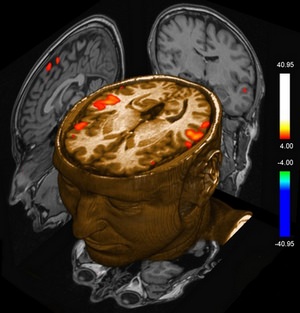 Lucid Dreams and fMRI Studies
