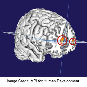 Lucid Dreamers Have a Larger Prefrontal Cortex