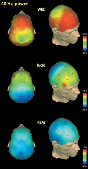 Lucid Dreams Found to Take Place at Gamma Brainwave Frequencies