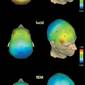 Lucid Dreams Found to Take Place at Gamma Brainwave Frequencies