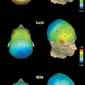 Lucid Dreams Found to Take Place at Gamma Brainwave Frequencies