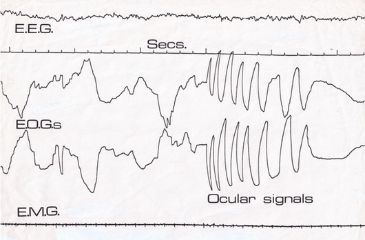 The First Proof of Lucid Dreaming