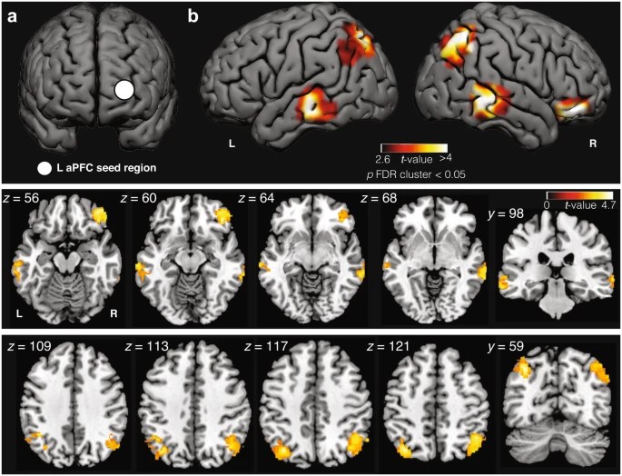 Self-awareness in lucid dreams